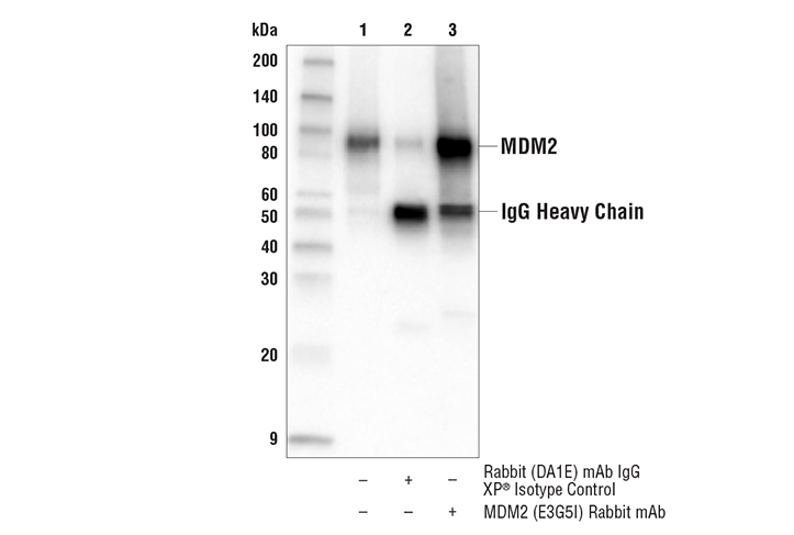 Immunoprecipitation Image 1: MDM2 (E3G5I) Rabbit mAb