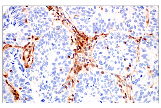 Immunohistochemistry Image 1: SERPINB9 (E9J8J) XP® Rabbit mAb (BSA and Azide Free)