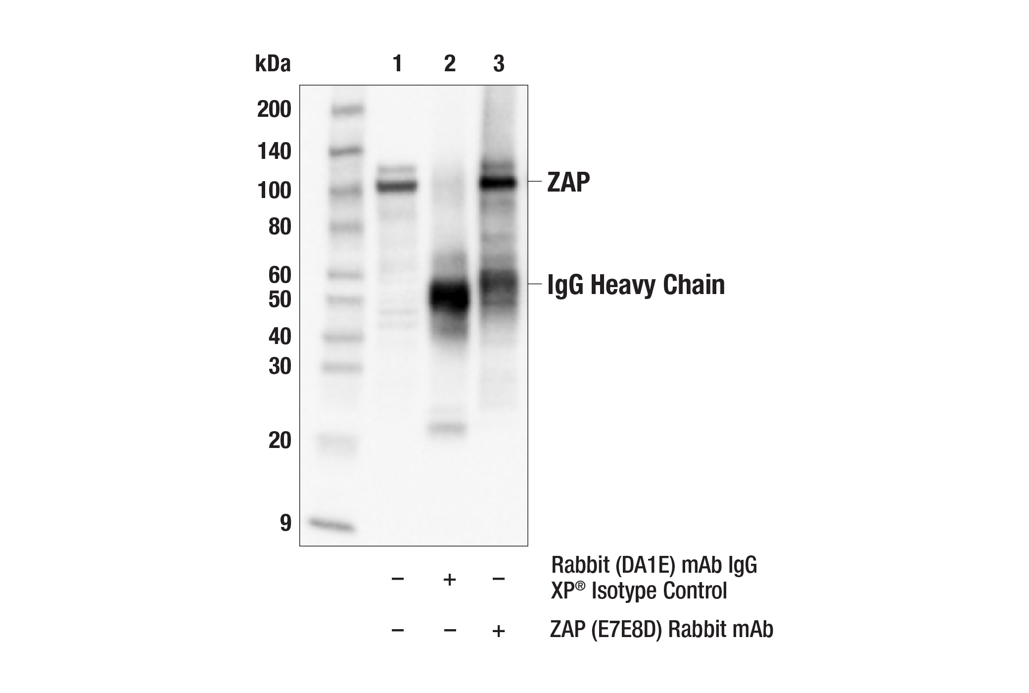 Immunoprecipitation Image 1: ZAP (E7E8D) Rabbit mAb