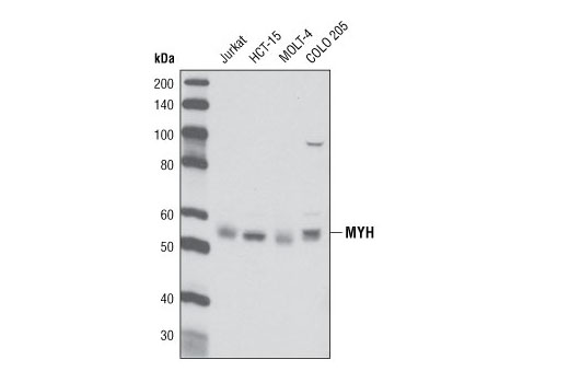 Western Blotting Image 1: MYH Antibody