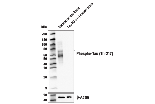  Image 18: Phospho-Tau (Ser214/T217) Signaling Antibody Sampler Kit