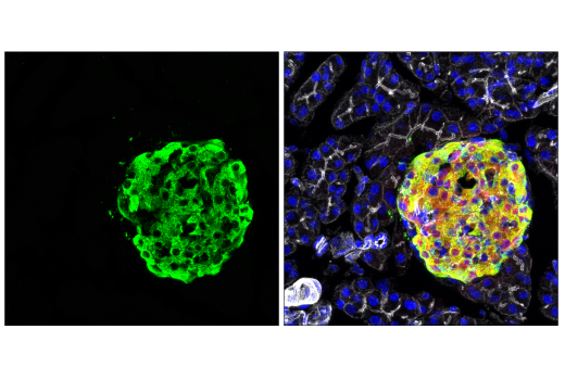 Immunofluorescence Image 1: C-Peptide (E9C4P) Rabbit mAb
