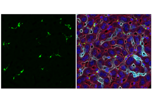 Immunofluorescence Image 1: CD68 (E3O7V) Rabbit mAb (Alexa Fluor® 488 Conjugate)