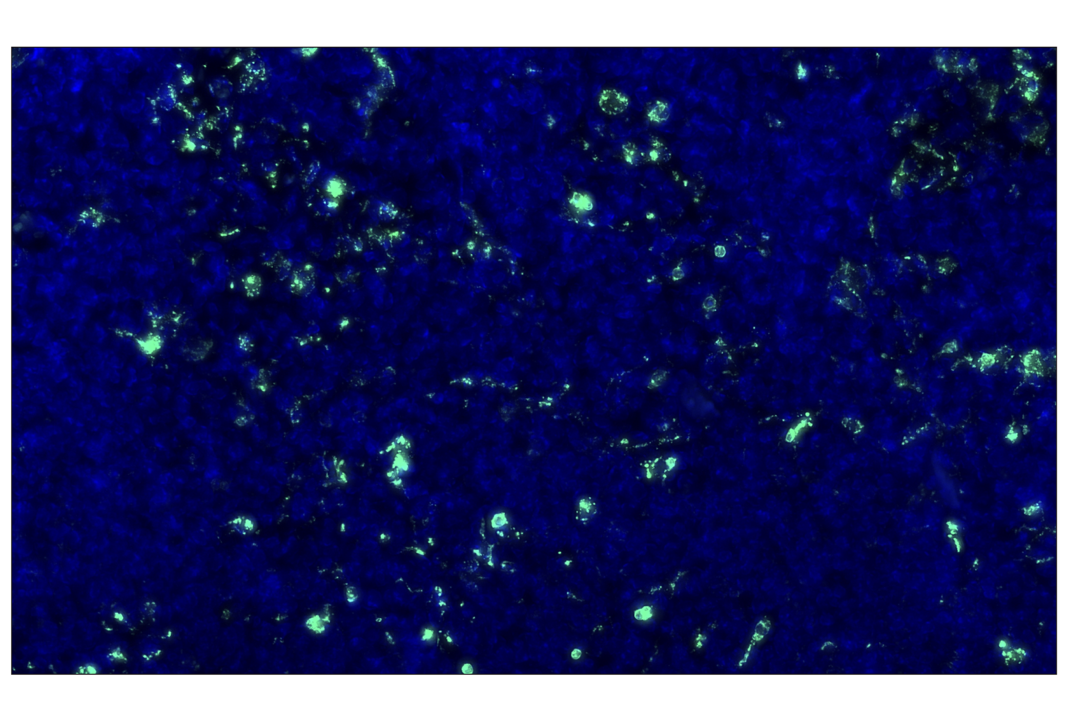 Immunohistochemistry Image 2: CD68 (E3O7V) Rabbit mAb (Alexa Fluor® 488 Conjugate)