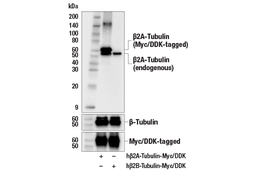 Western Blotting Image 2: β2A-Tubulin Antibody