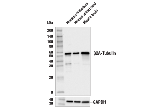 Western Blotting Image 1: β2A-Tubulin Antibody