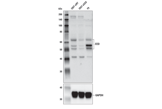  Image 7: Polycomb Group 2 (PRC2) Antibody Sampler Kit