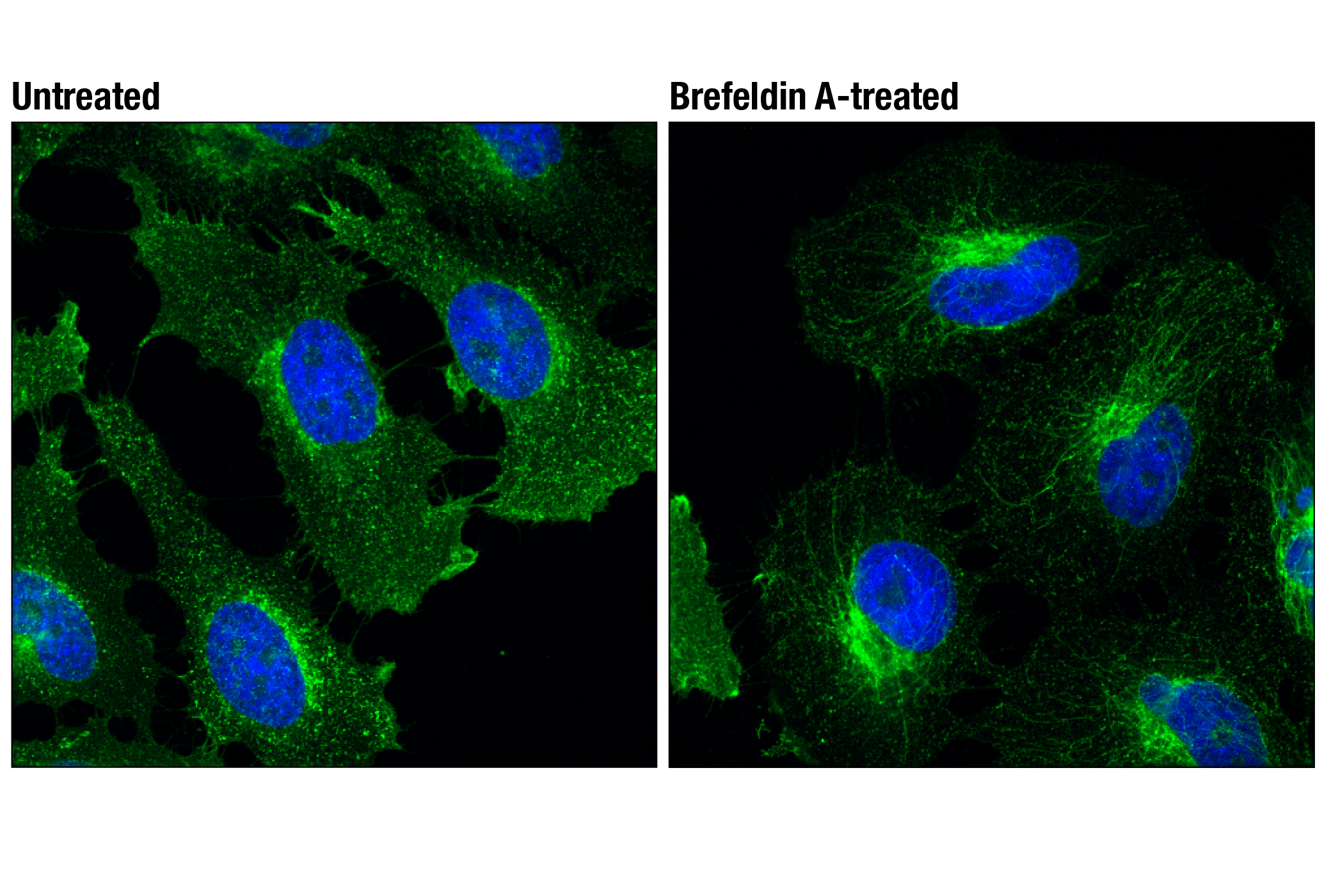 Immunofluorescence Image 1: Transferrin Receptor/CD71 (D7G9X) Rabbit Monoclonal Antibody (BSA and Azide Free)
