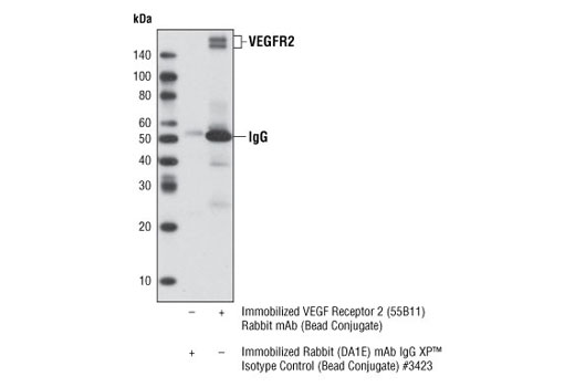 Immunoprecipitation Image 1: VEGF Receptor 2 (55B11) Rabbit mAb (Sepharose Bead® Conjugate)