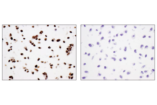 Immunohistochemistry Image 3: N-Myc (D4B2Y) Rabbit mAb (BSA and Azide Free)