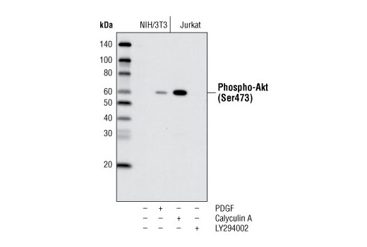 Western Blotting Image 1: Phospho-Akt (Ser473) (D9E) XP® Rabbit mAb (HRP Conjugate)