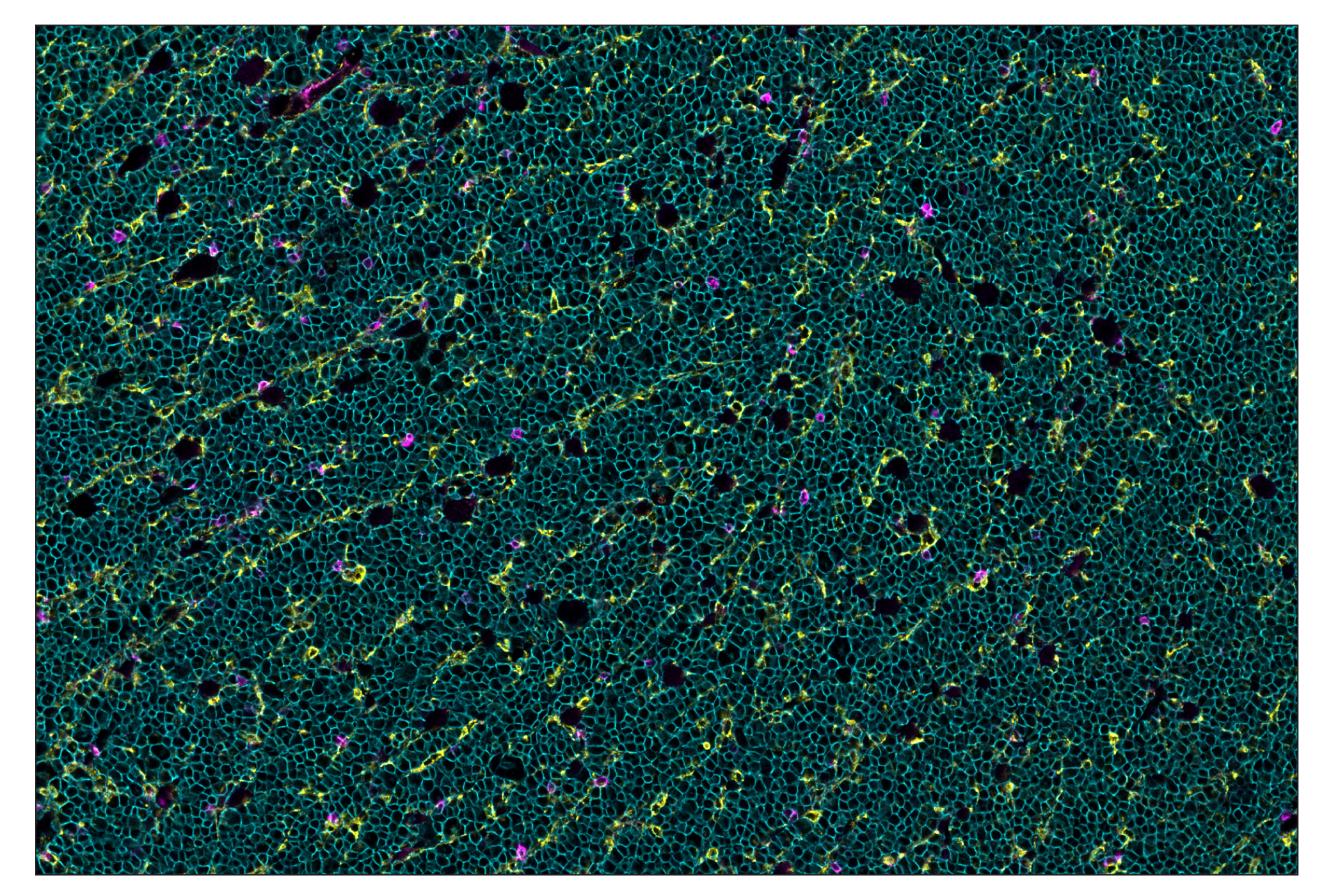 Immunohistochemistry Image 8: TIM-3 (D3M9R) & CO-0094-647 SignalStar™ Oligo-Antibody Pair
