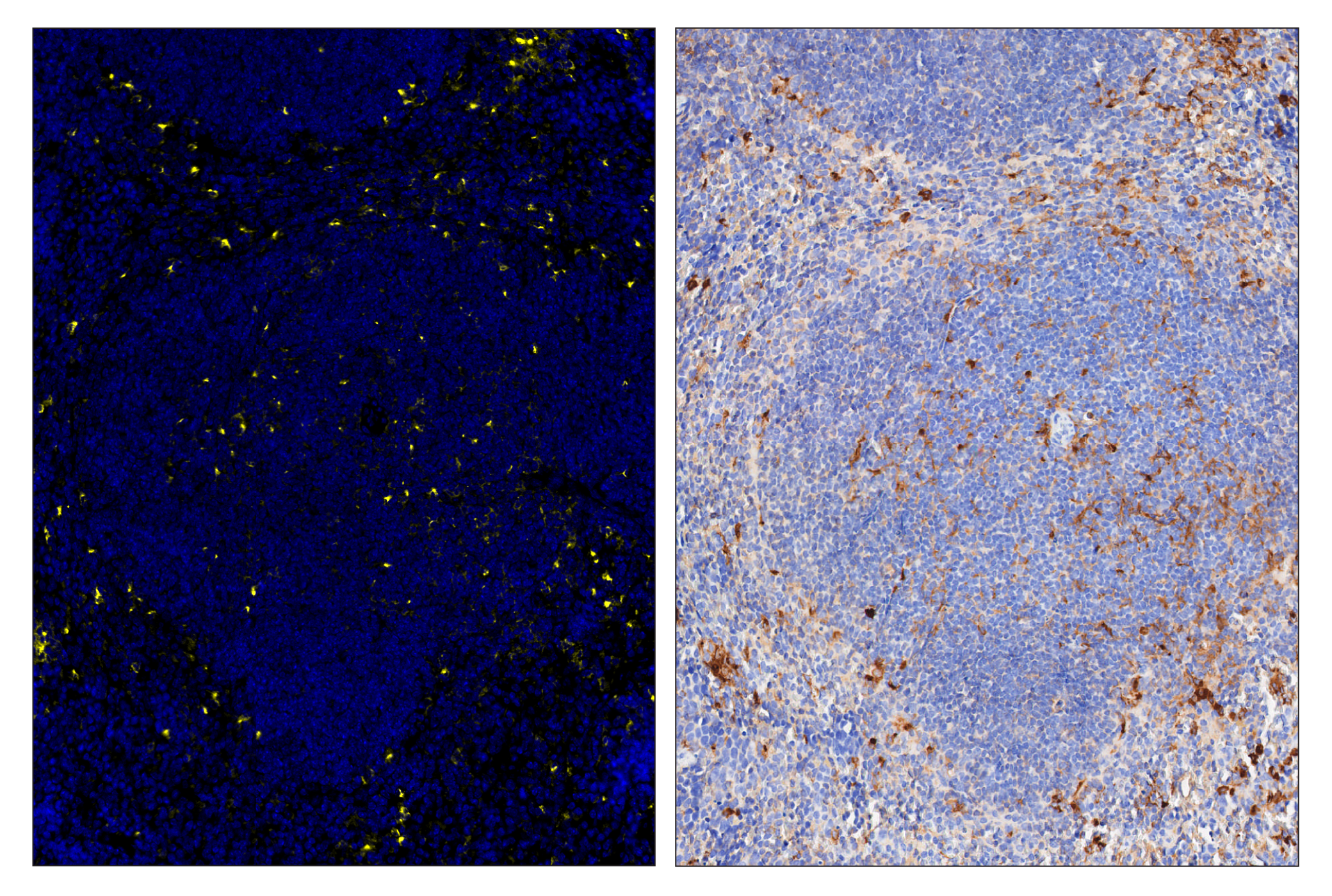 Immunohistochemistry Image 6: TIM-3 (D3M9R) & CO-0094-647 SignalStar™ Oligo-Antibody Pair