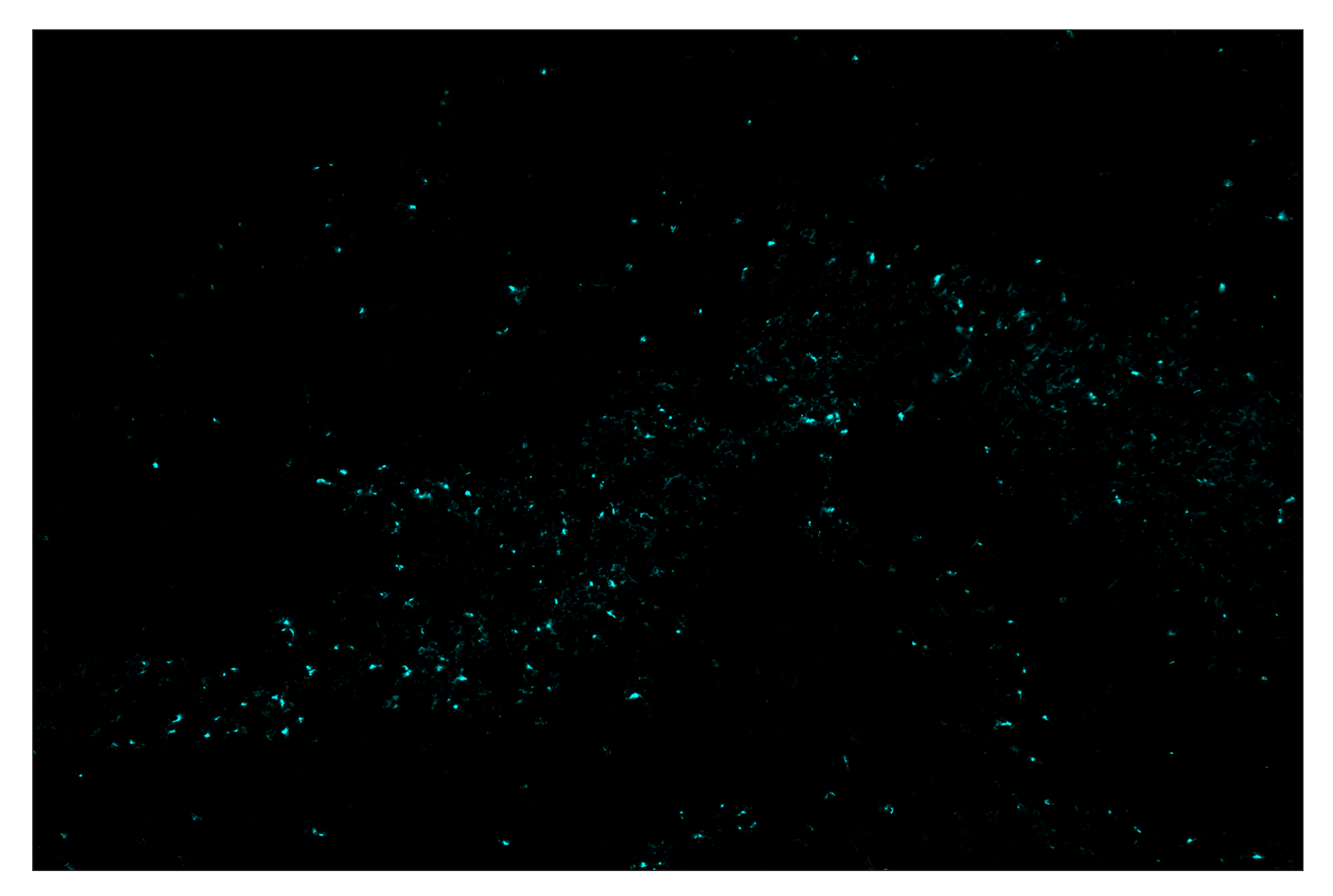 Immunohistochemistry Image 5: TIM-3 (D3M9R) & CO-0094-647 SignalStar™ Oligo-Antibody Pair