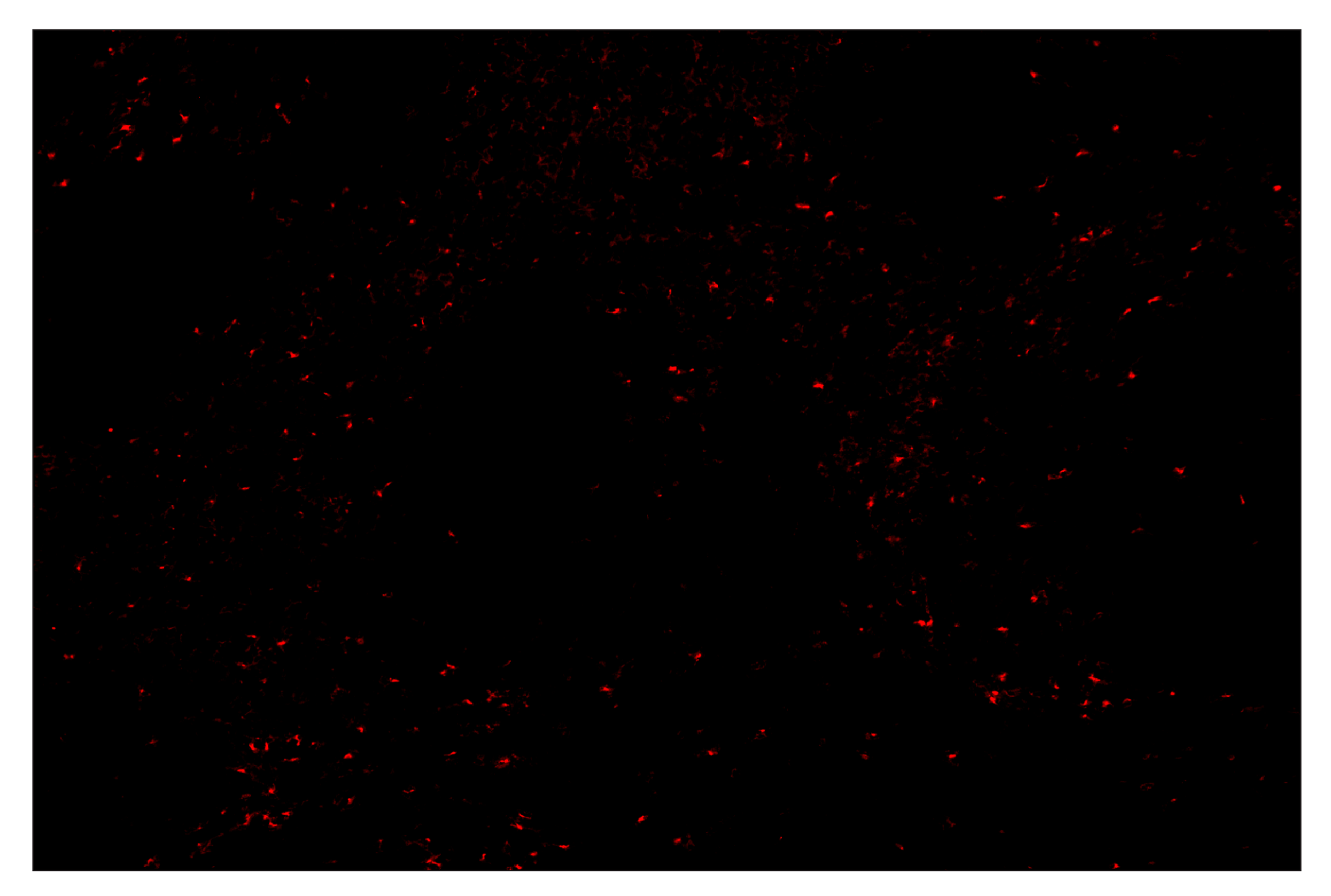 Immunohistochemistry Image 4: TIM-3 (D3M9R) & CO-0094-647 SignalStar™ Oligo-Antibody Pair