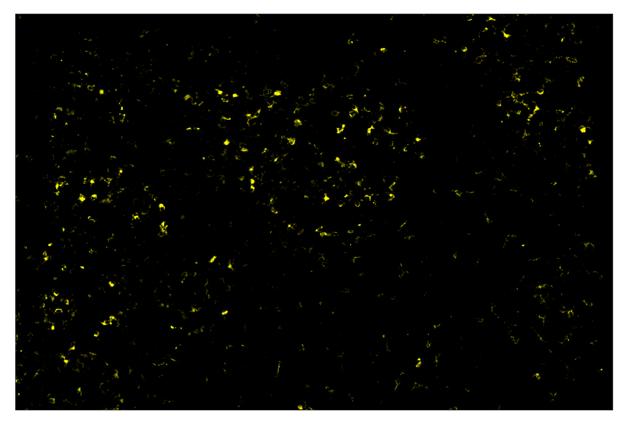 Immunohistochemistry Image 3: TIM-3 (D3M9R) & CO-0094-647 SignalStar™ Oligo-Antibody Pair