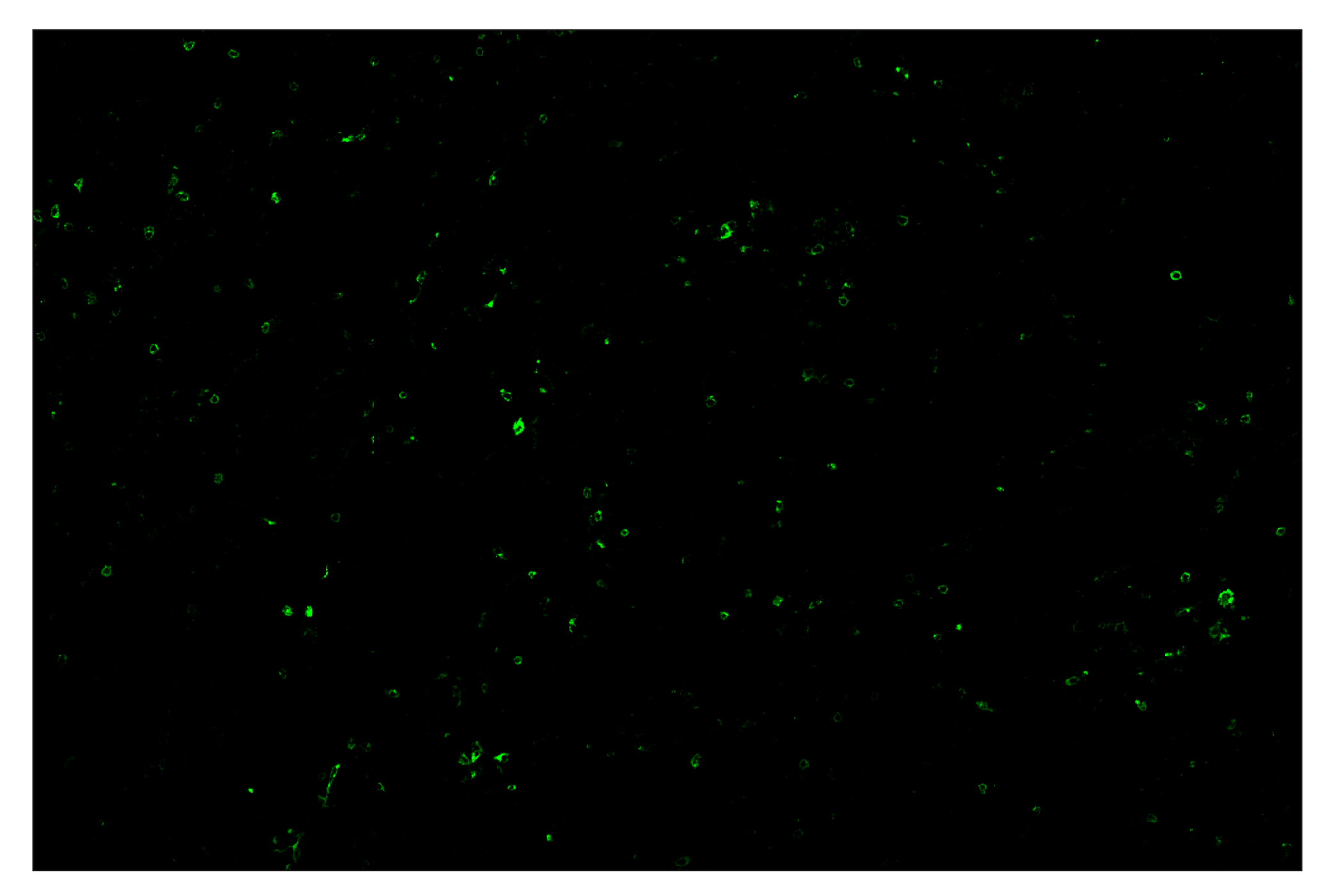 Immunohistochemistry Image 2: TIM-3 (D3M9R) & CO-0094-647 SignalStar™ Oligo-Antibody Pair