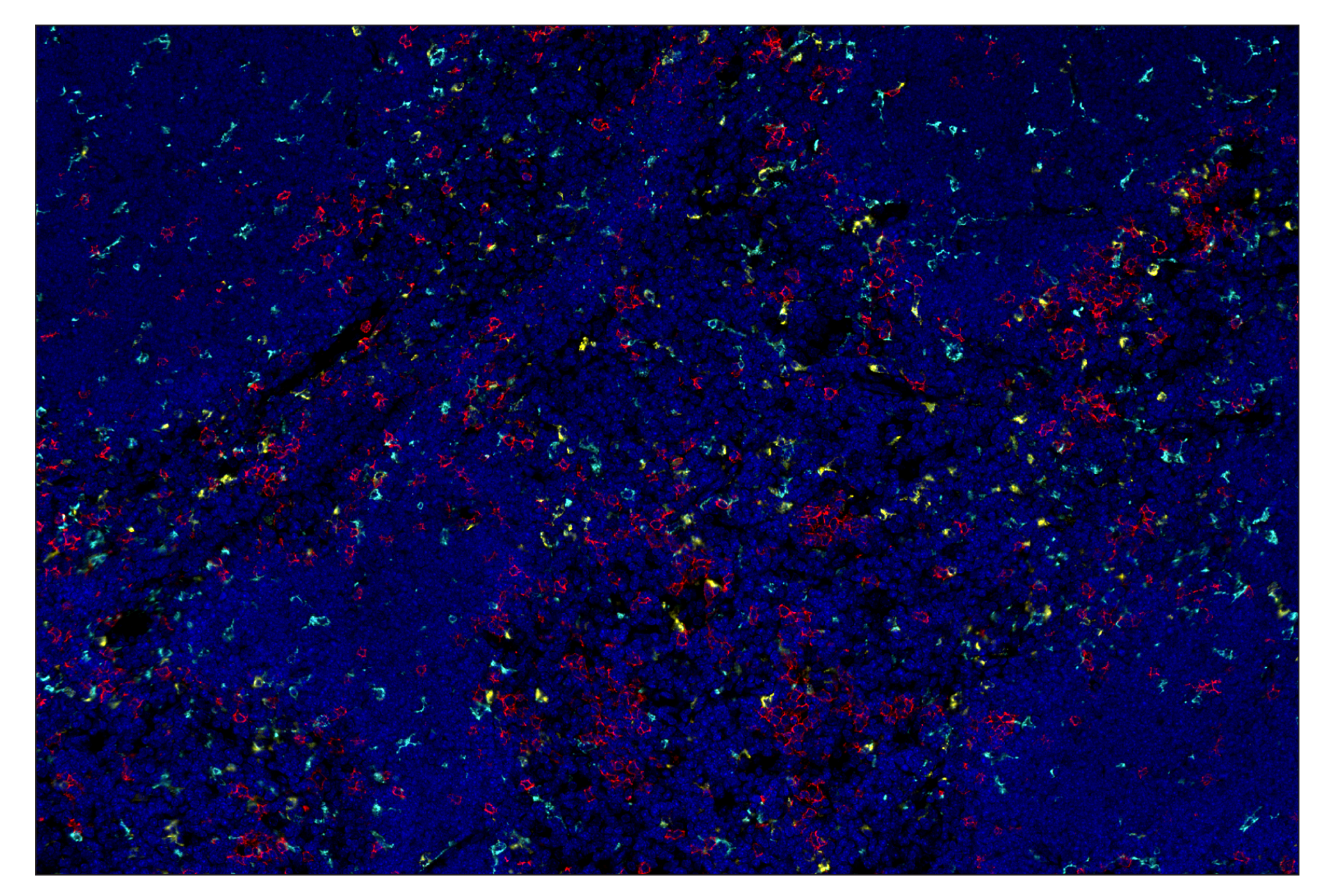 Immunohistochemistry Image 7: TIM-3 (D3M9R) & CO-0094-647 SignalStar™ Oligo-Antibody Pair