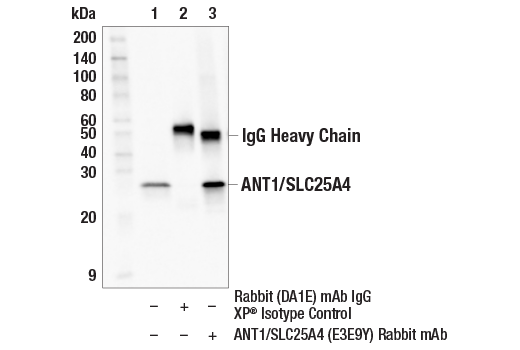 Immunoprecipitation Image 1: ANT1/SLC25A4 (E3E9Y) Rabbit mAb