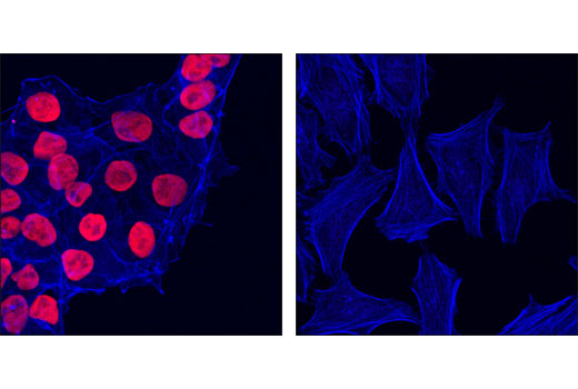 Immunofluorescence Image 1: Sox2 (D6D9) XP® Rabbit mAb (Alexa Fluor® 555 Conjugate)