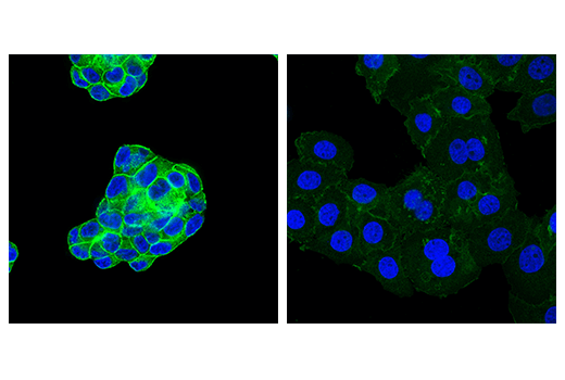 Immunofluorescence Image 3: Ras (E4K9L) Rabbit mAb (Alexa Fluor®488 Conjugate)
