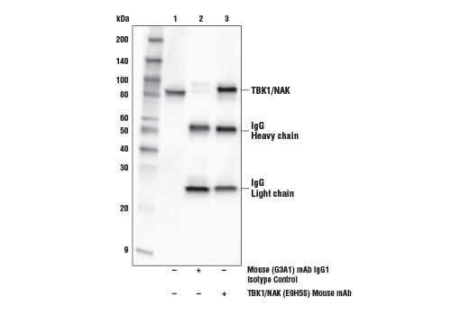 Immunoprecipitation Image 1: TBK1/NAK (E9H5S) Mouse mAb