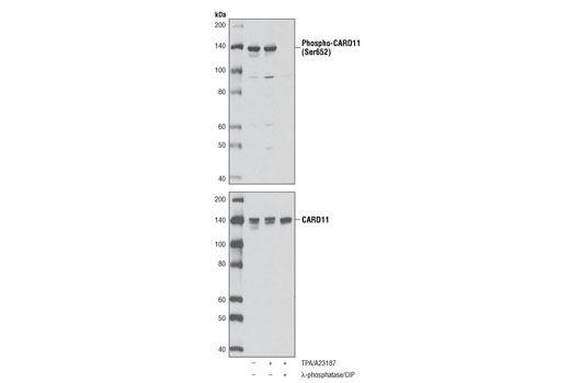 Western Blotting Image 1: Phospho-CARD11 (Ser652) Antibody