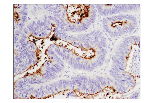 Immunohistochemistry Image 3: CD133 (D2V8Q) XP® Rabbit mAb (BSA and Azide Free)