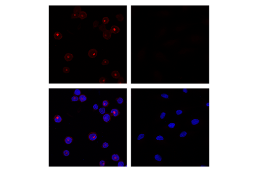 Immunofluorescence Image 1: Neutrophil Elastase (E9C9L) XP® Rabbit mAb (Alexa Fluor® 594 Conjugate)