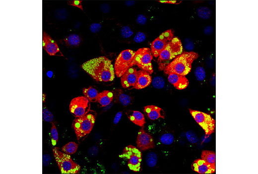Immunofluorescence Image 1: Lipin 1 Antibody