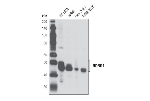 Western Blotting Image 1: NDRG1 Antibody
