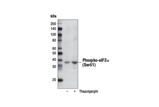 Western Blotting Image 1: Phospho-eIF2α (Ser51) (D9G8) XP® Rabbit mAb (Biotinylated)
