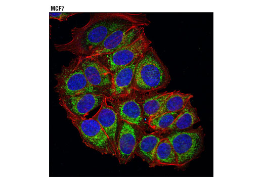 Immunofluorescence Image 1: AKAP1 (D9C5) XP® Rabbit mAb