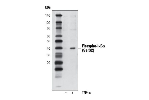 Western Blotting Image 1: Phospho-IκBα (Ser32) (14D4) Rabbit mAb (Biotinylated)