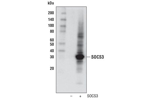 Image 10: Jak/Stat Pathway Inhibitors Antibody Sampler Kit
