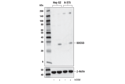  Image 5: Jak/Stat Pathway Inhibitors Antibody Sampler Kit