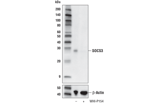  Image 13: Jak/Stat Pathway Inhibitors Antibody Sampler Kit