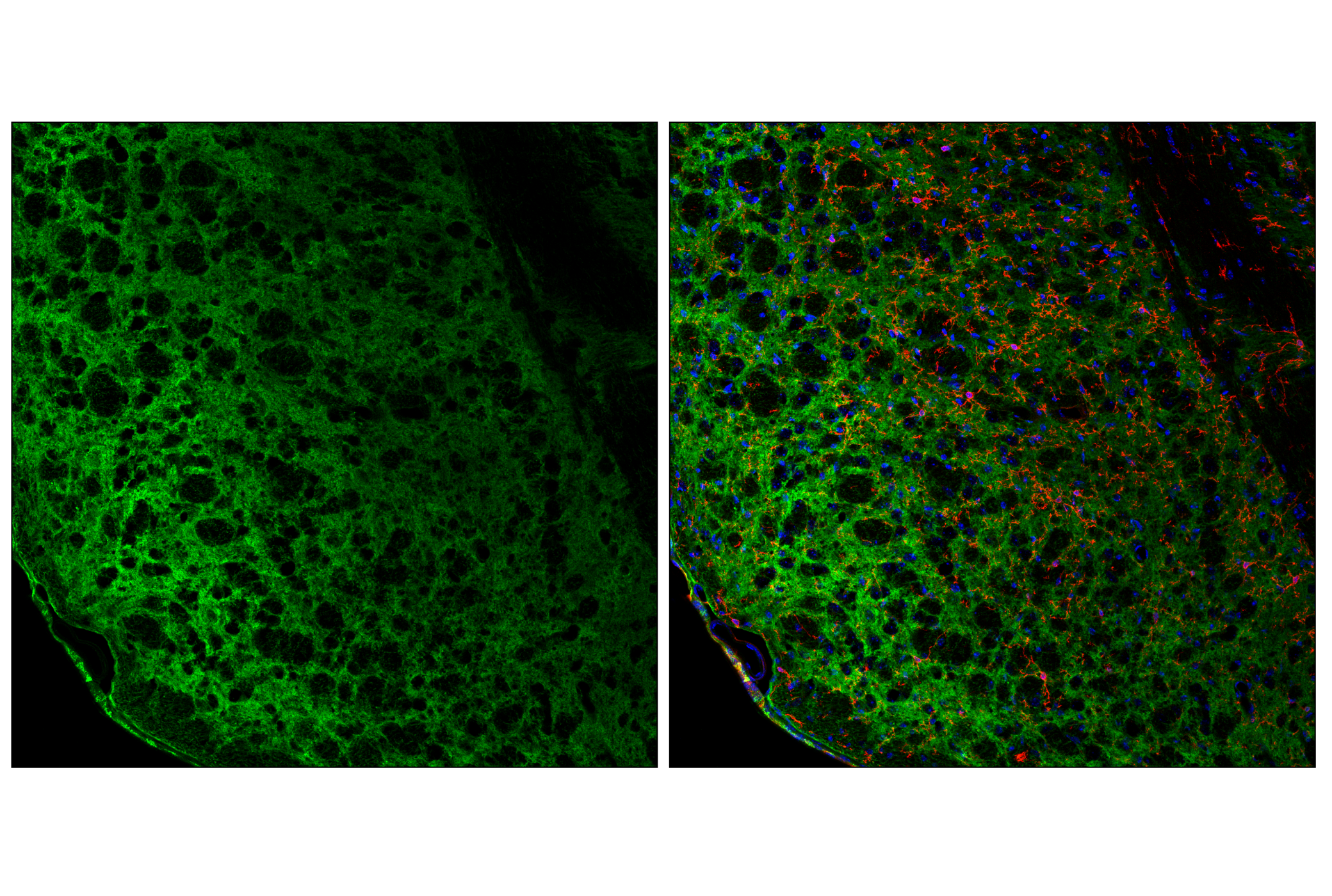 Immunofluorescence Image 2: EAAT1 (F8N7H) Mouse mAb