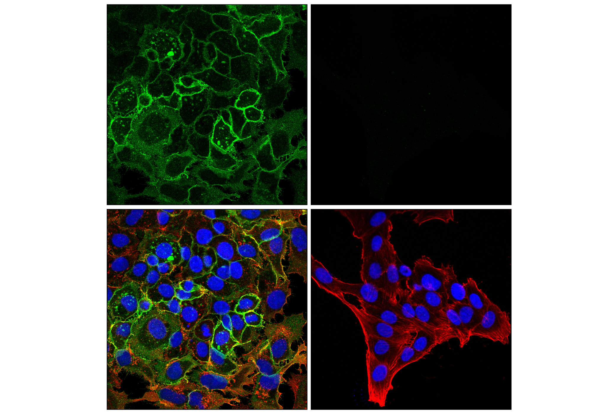 Immunofluorescence Image 1: ENPP1 (E3R8O) Rabbit mAb
