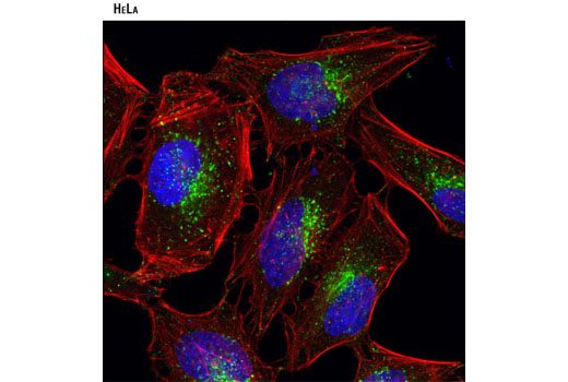 Immunofluorescence Image 1: LAMP1 (D2D11) XP® Rabbit mAb (BSA and Azide Free)