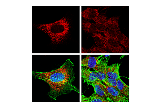 Immunofluorescence Image 1: Calreticulin (D3E6) XP® Rabbit mAb (Alexa Fluor® 555 Conjugate)