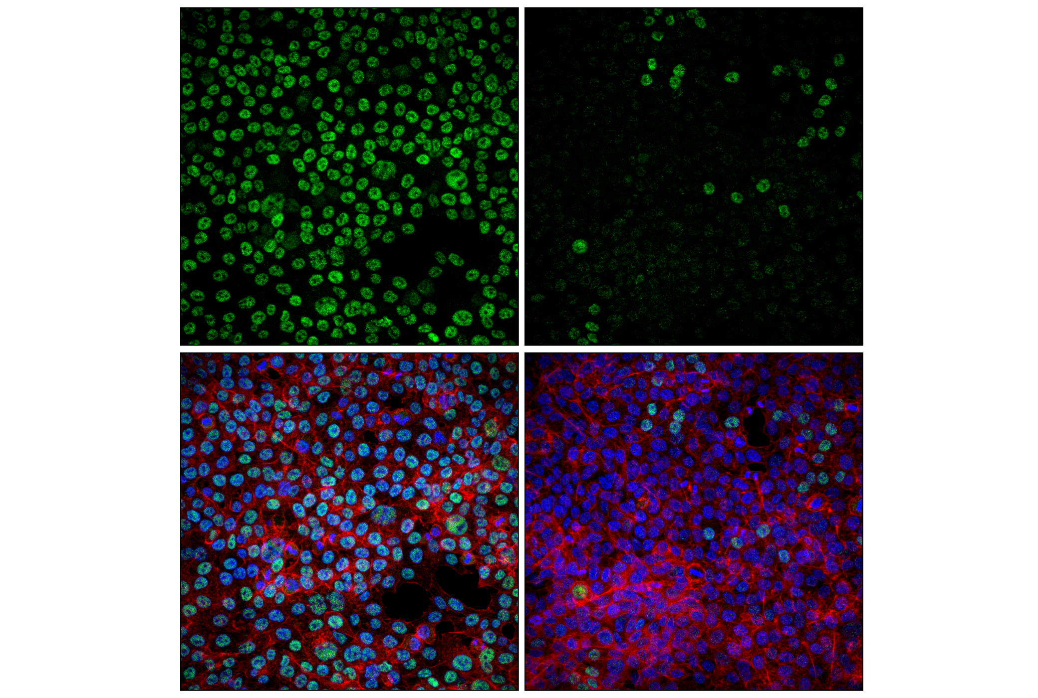 Immunofluorescence Image 1: USP22 (F4M4V) Rabbit mAb