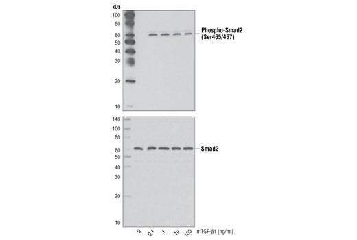  Image 3: Mouse Transforming Growth Factor β1 (mTGF-β1)