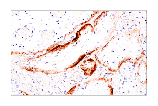 Immunohistochemistry Image 1: SARS-CoV-1/2 Spike Protein (2B3E5) Mouse mAb