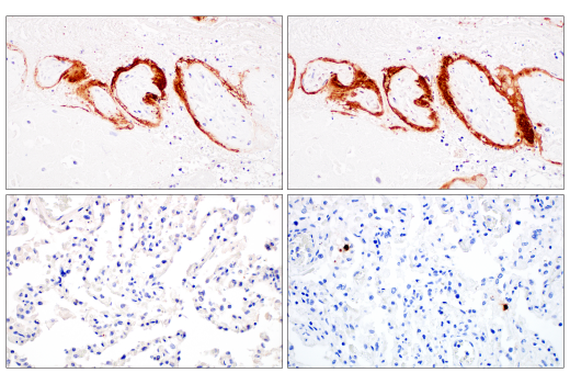 Immunohistochemistry Image 2: SARS-CoV-1/2 Spike Protein (2B3E5) Mouse mAb