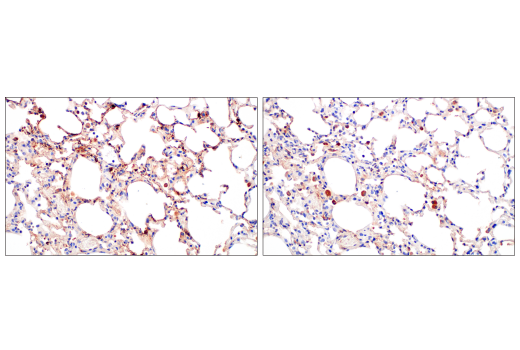 Immunohistochemistry Image 3: SARS-CoV-1/2 Spike Protein (2B3E5) Mouse mAb
