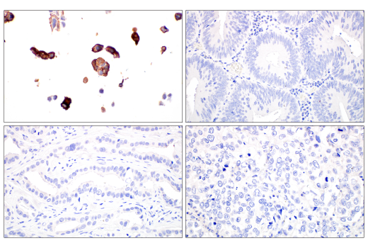Immunohistochemistry Image 4: SARS-CoV-1/2 Spike Protein (2B3E5) Mouse mAb