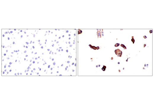 Immunohistochemistry Image 5: SARS-CoV-1/2 Spike Protein (2B3E5) Mouse mAb