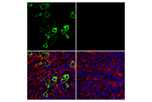 Immunofluorescence Image 1: SARS-CoV-1/2 Spike Protein (2B3E5) Mouse mAb