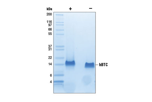  Image 3: Human Betacellulin (hBTC)